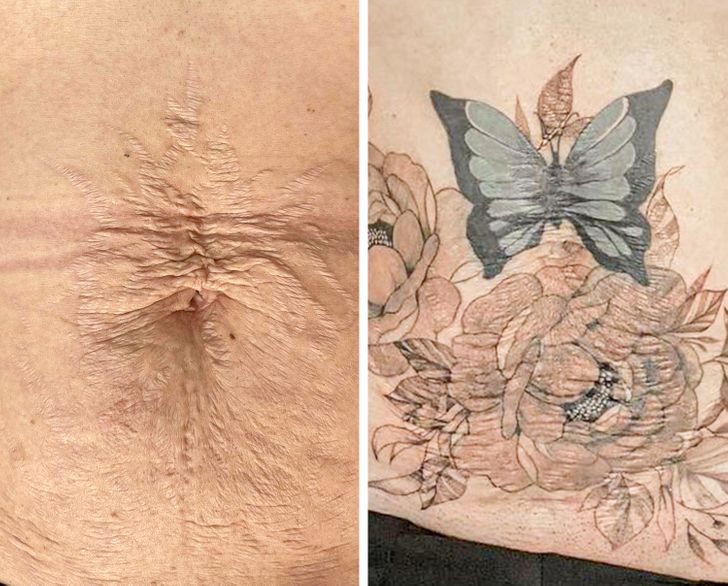 Turning Scars Into Art: 16 Powerful Tattoo Cover-Ups That Celebrate Healing
