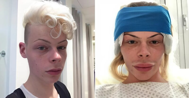 He spent $73,000 on surgeries to look like a woman — see how he looks today.