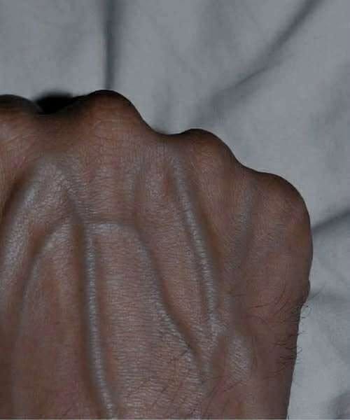 If you have visible veins, it means…