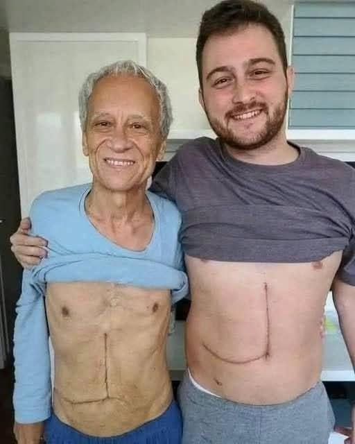 Son who donated part of his liver to his father unfortunately ends up fa… See more
