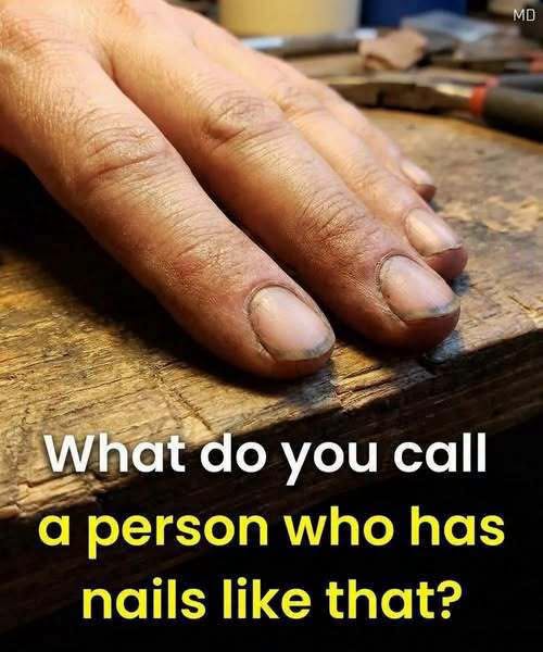Before You Judge: What Dirty Nails Might Actually Mean It’s easy to notice someone’s hands.